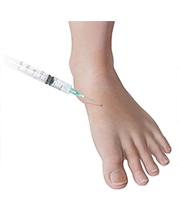 Cortisone Injections