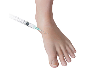 Cortisone Injections