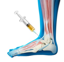 Platelet-Rich Plasma