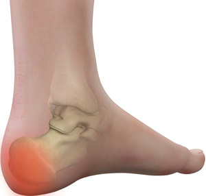 pain in the back of ankle and heel